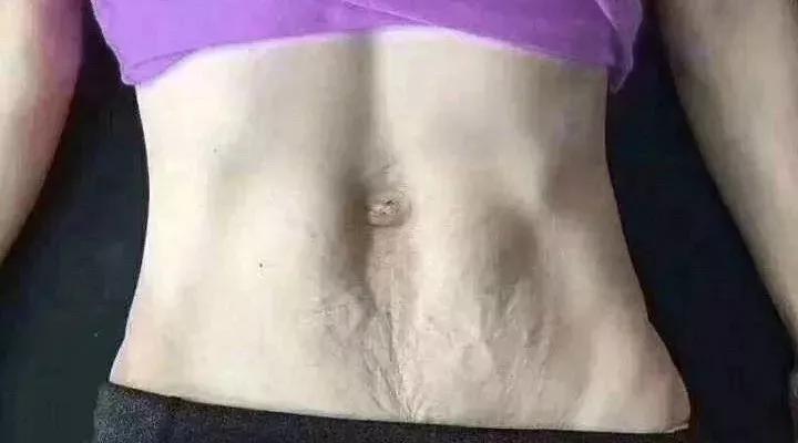 身材走样赘肉明显,身材走样会不会嫌弃