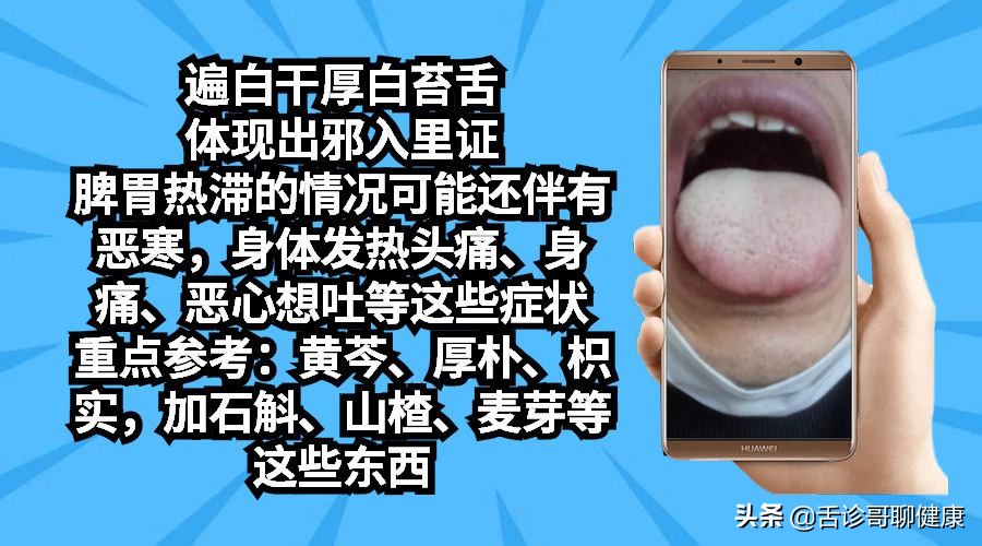 抖音舌诊哥舌象感悟：强迫症、大便不成型、忧心忡忡