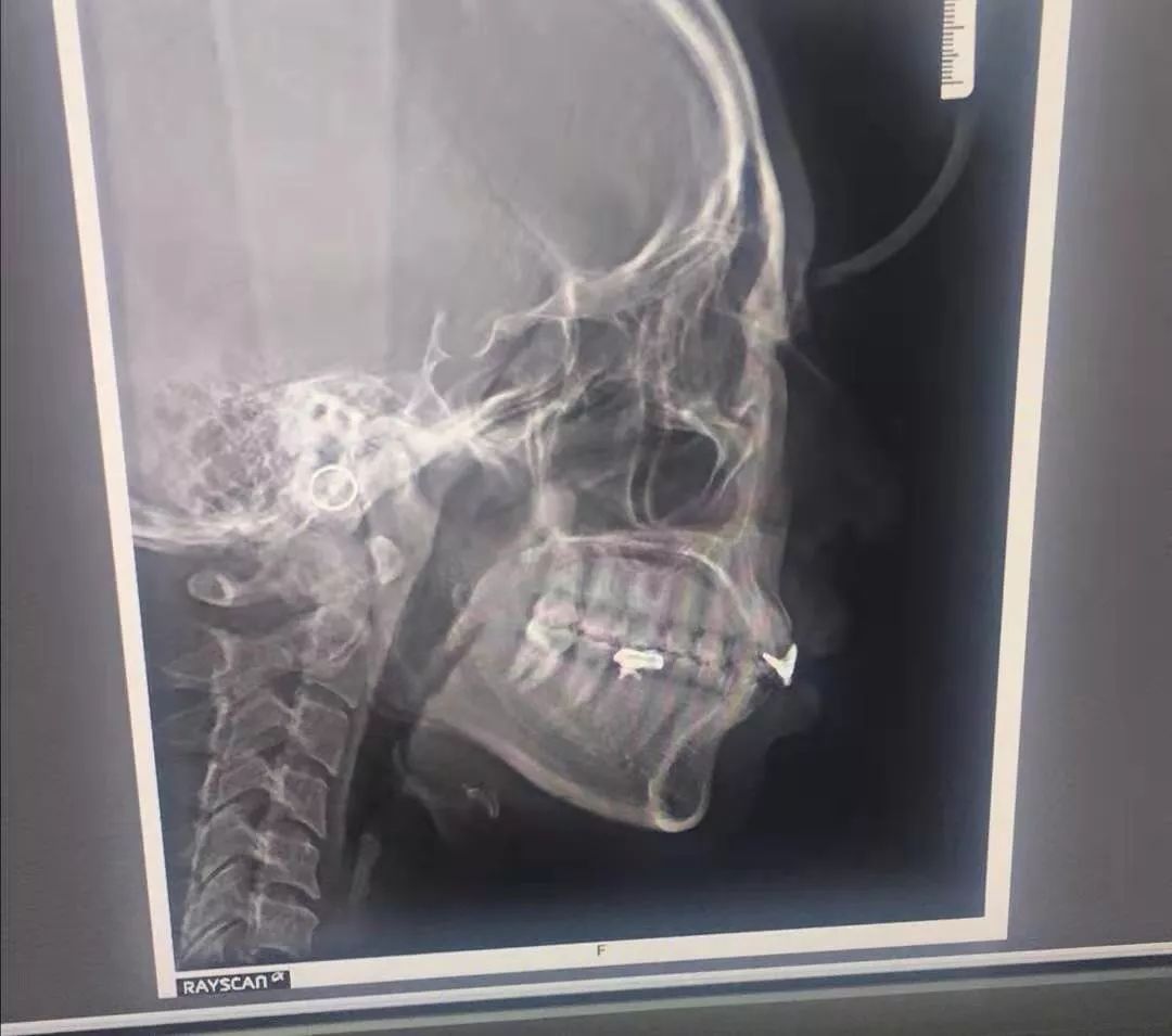 重启后的我,重启后时间变了是为什么