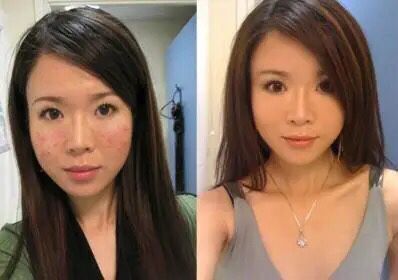 美容针变“毒针”，19岁女孩被毁容，医生：打针有风险跟风需谨慎