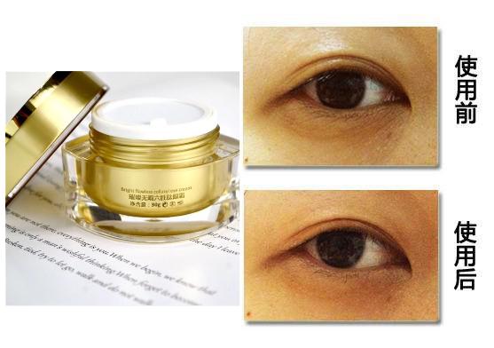 五种方法轻松搞定你的眼袋,眼袋太黑太重怎么办