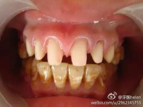 Helen齿科中心,helen牙齿