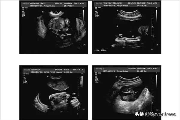 seventrees进口母婴加盟网店,seventrees进口母婴品牌怎么样