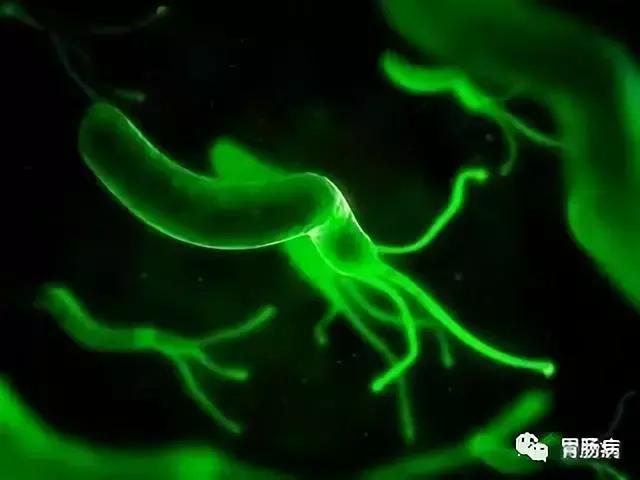 幽门螺杆菌为什么杀不死,幽门螺杆菌根除失败后的补救方案