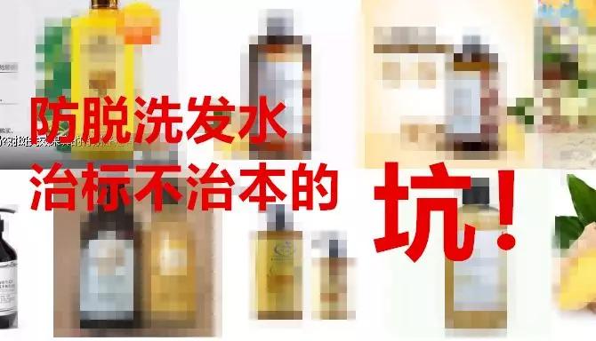 头油头屑痒洗发水,头油头皮屑多脱发洗发水