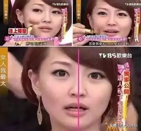 倪妮瘦脸针,倪妮脸型打了瘦脸针了么