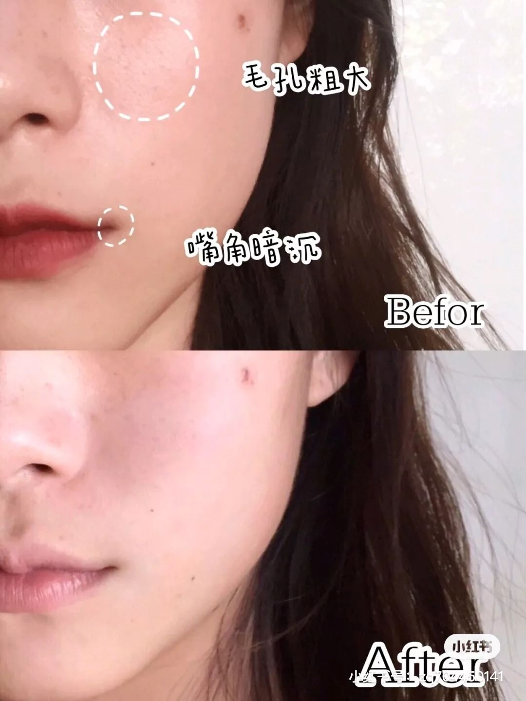 我用空瓶了几十瓶面霜的经验告诉你,谁才是真正的干皮亲妈