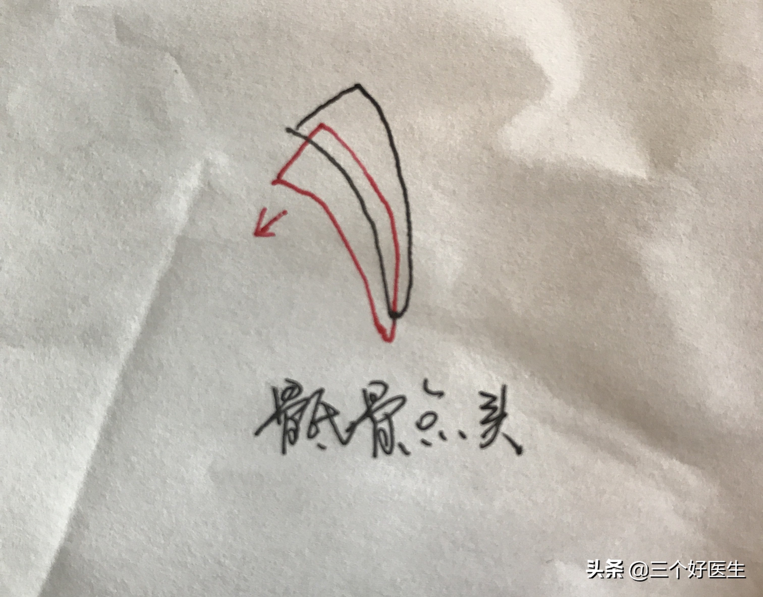 骶骨仰头错位腿会变长吗,骶骨仰头就是骶骨上翘吗