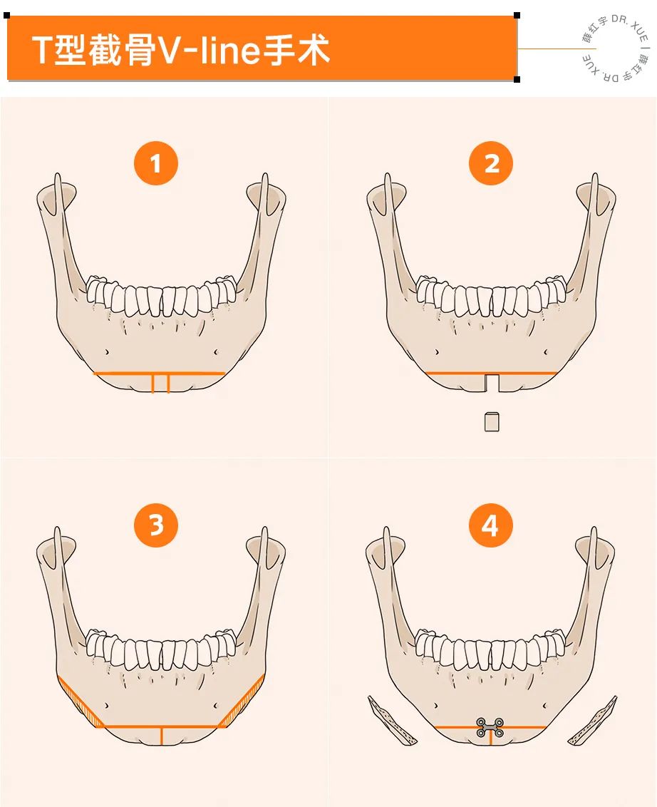 下巴宽厚的人,头尖下巴宽厚