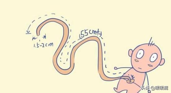 脐带绕颈几周会畸形,脐带扭转和脐带绕颈的区别