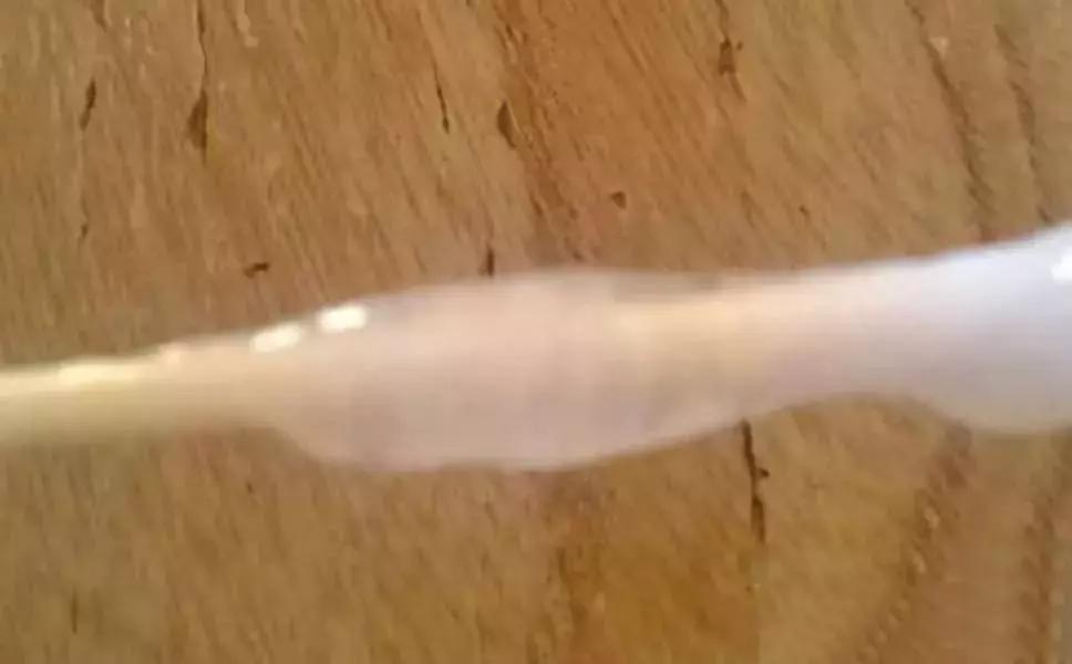 *裤内**总是有“东西”，怎么办？