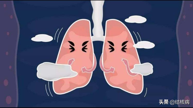 结核病的各种合并症和并发症,结核病有哪些并发症