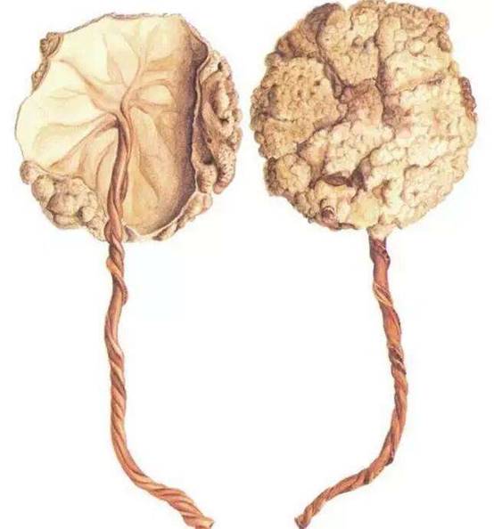 胎盘真可以吃吗,胎盘真能吃吗