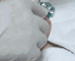 医美做什么能永远不长痘,脸很多痘坑做什么医美