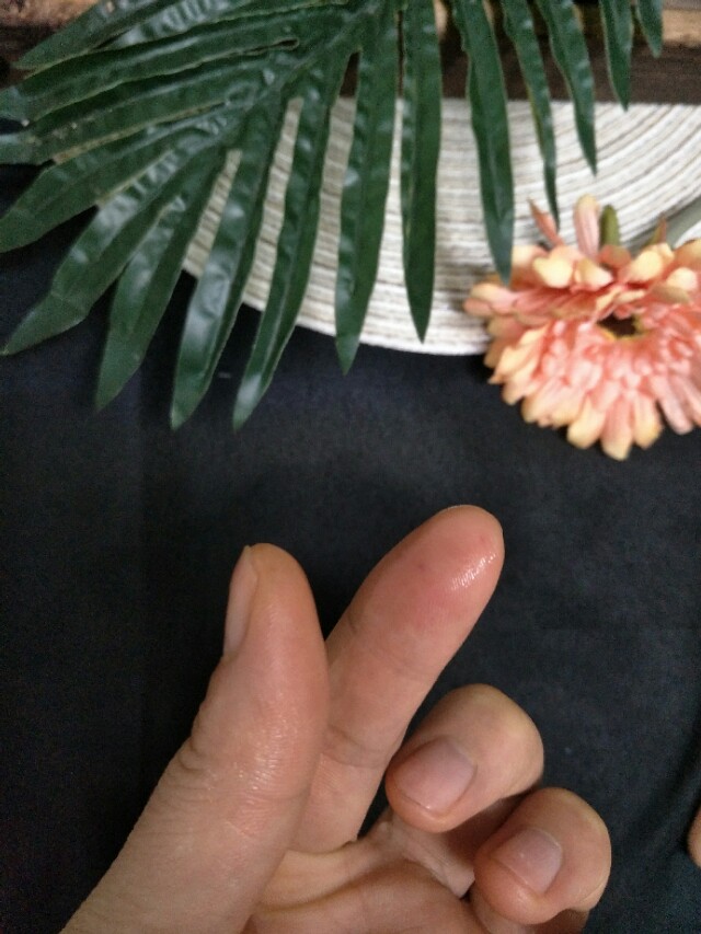 粘到502胶水了怎么才能解开,502胶水粘到手一招轻松解决