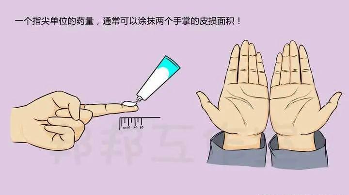 战痘神器阿达帕林 (怎么防止阿达帕林爆痘)