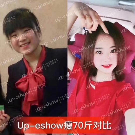 中萃片减肥副作用是什么最新,减肥黑科技是真的吗