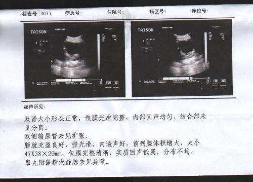 前方预警！敏感的“*弟弟小**”是时候去做个体检了！
