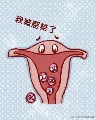 告诉你不知道的上环常识,关于上环的那些事科普