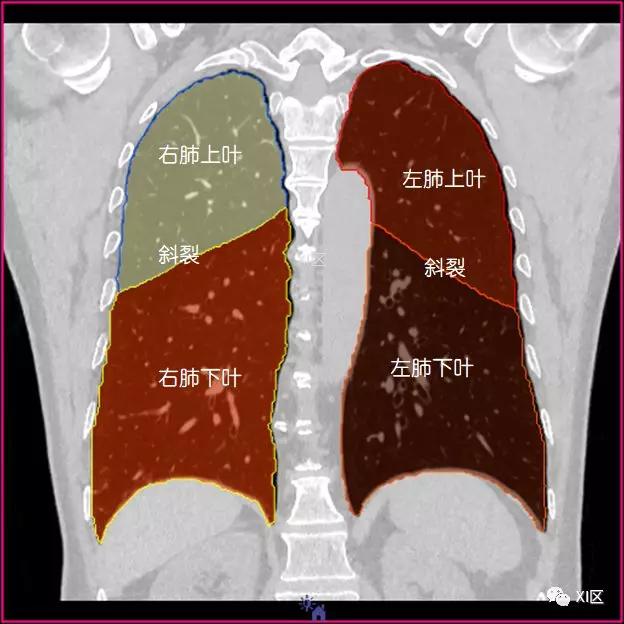 如此详细的肺部影像解剖，有点儿酷