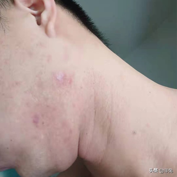 非兔fw03测评,非兔魔手测评