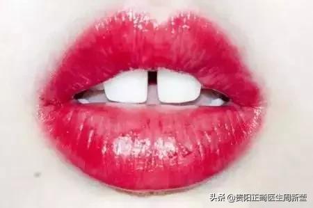 牙缝大吃东西老是塞牙怎么解决,牙缝大吃东西塞牙怎么补救最快