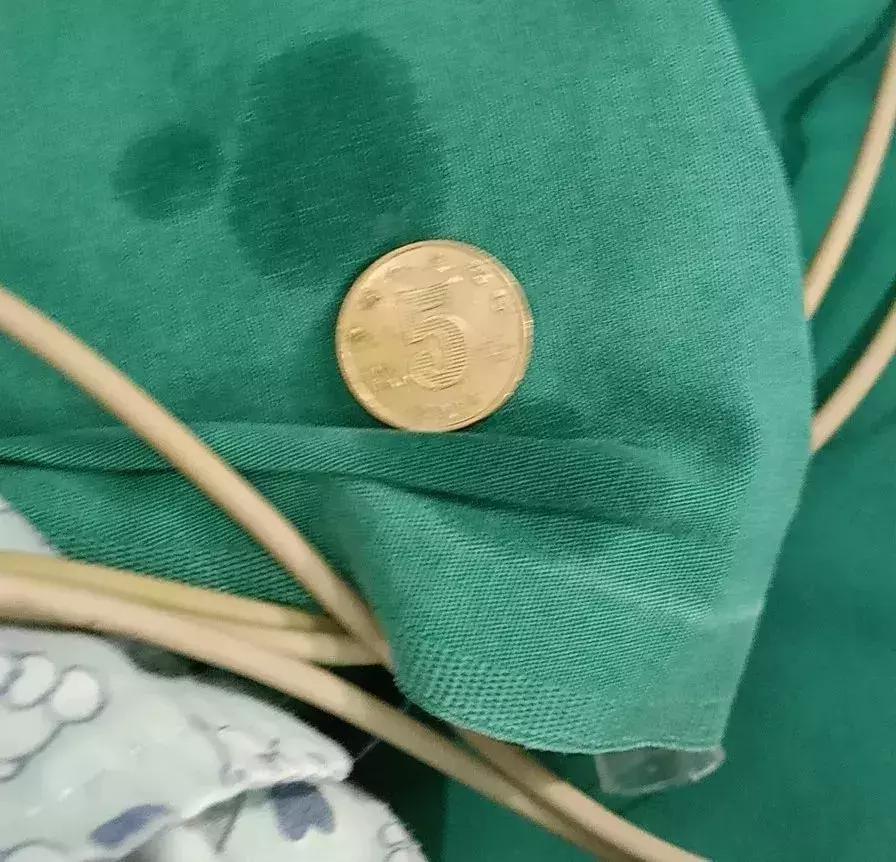 小孩先天性食道被塞什么引起的,一岁女童胃部被撑破