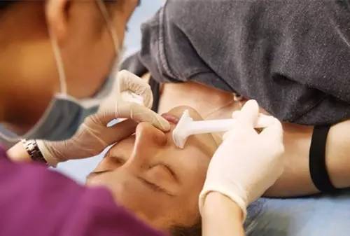 激光脱唇毛最真实测评,脱唇毛方法测评