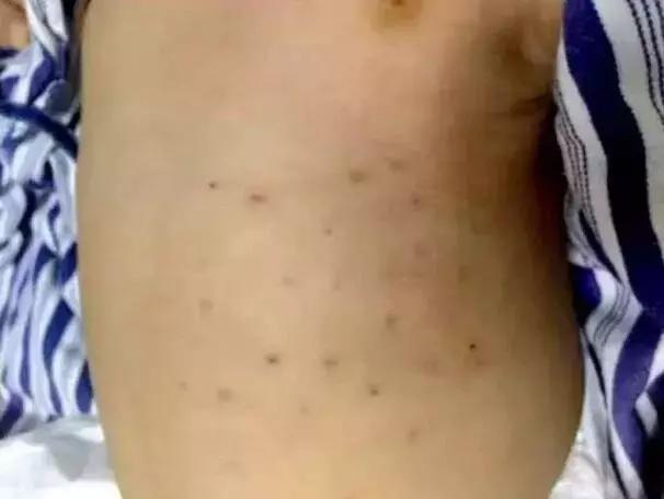 50天宝宝闹觉原因,50天宝宝闹人怎么办最有效