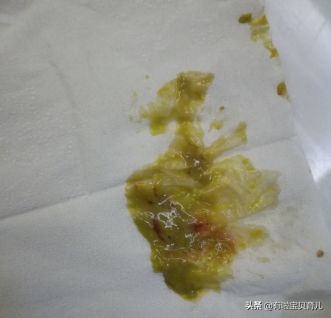 宝宝拉绿便不怎么长肉喝什么奶粉,宝宝拉绿色便便是妈妈吃凉的了吗