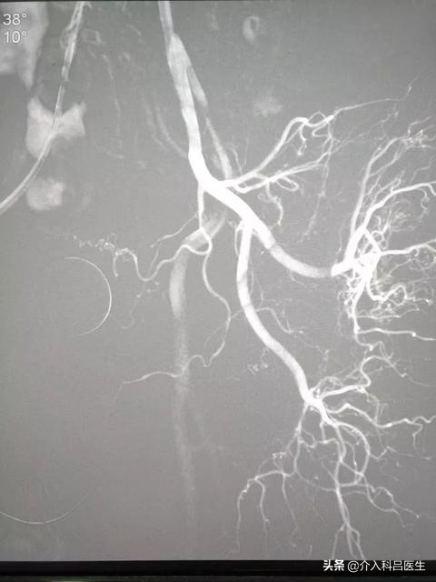 吃了前列腺的药怎么没见效,中药调理前列腺需要多久可以见效