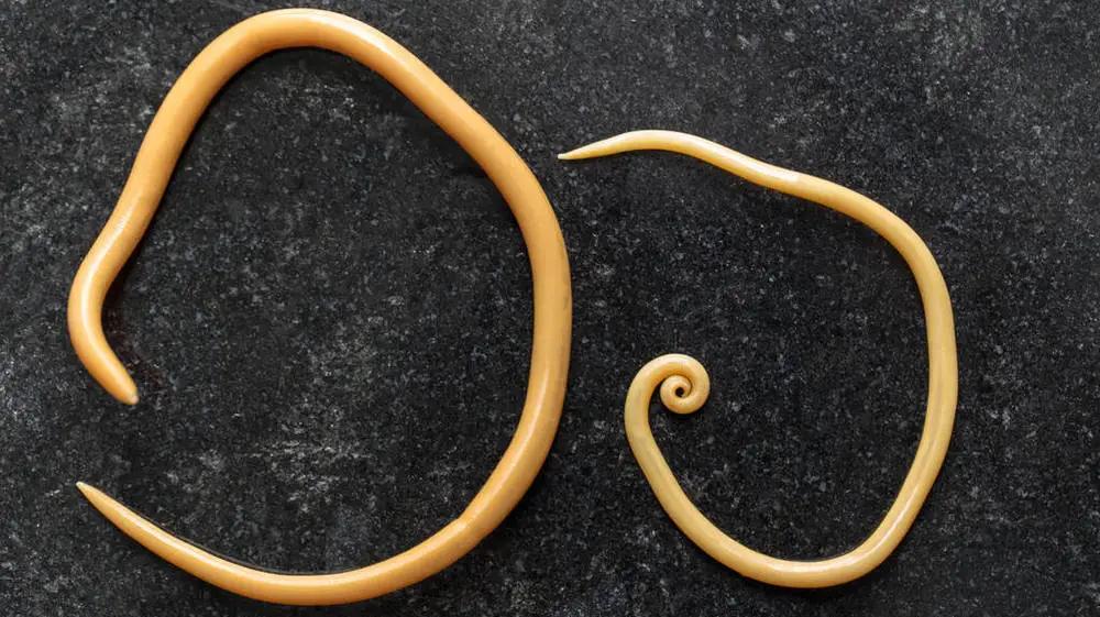 现在还存在蛔虫病吗,为何现在没人感染蛔虫了