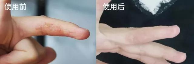 最强蜂胶,超级天然蜂胶