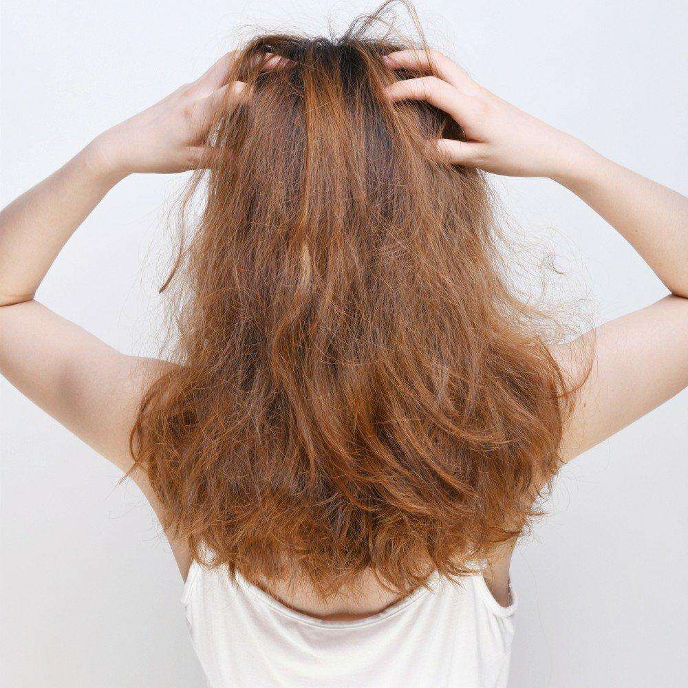 头发出油干燥脱发是什么原因,夏季头发出油严重