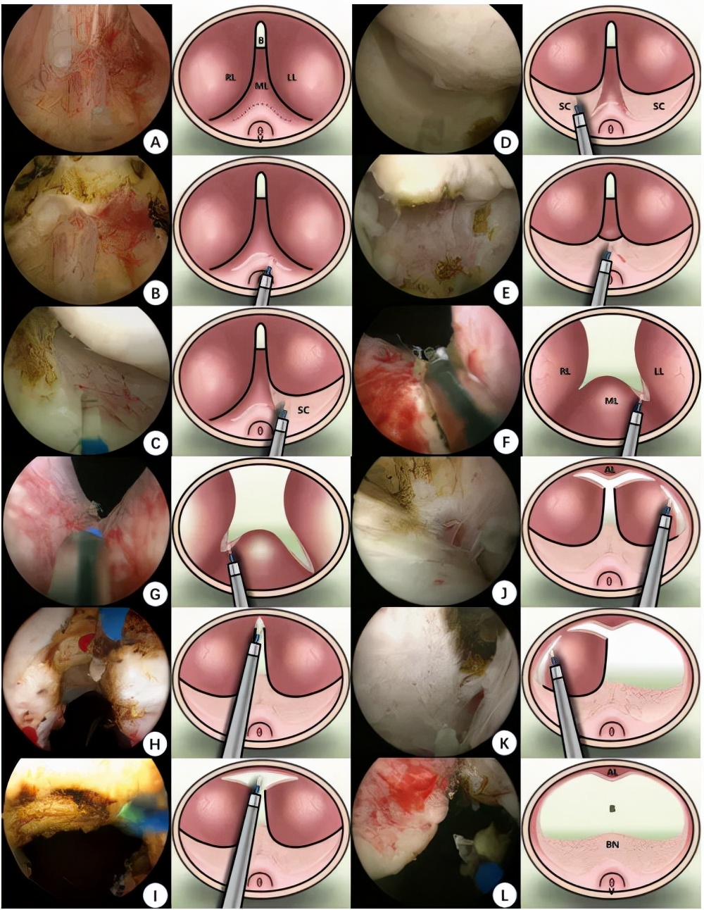 男科前列腺治疗室治疗的经历,腔道介入治疗仪治前列腺炎