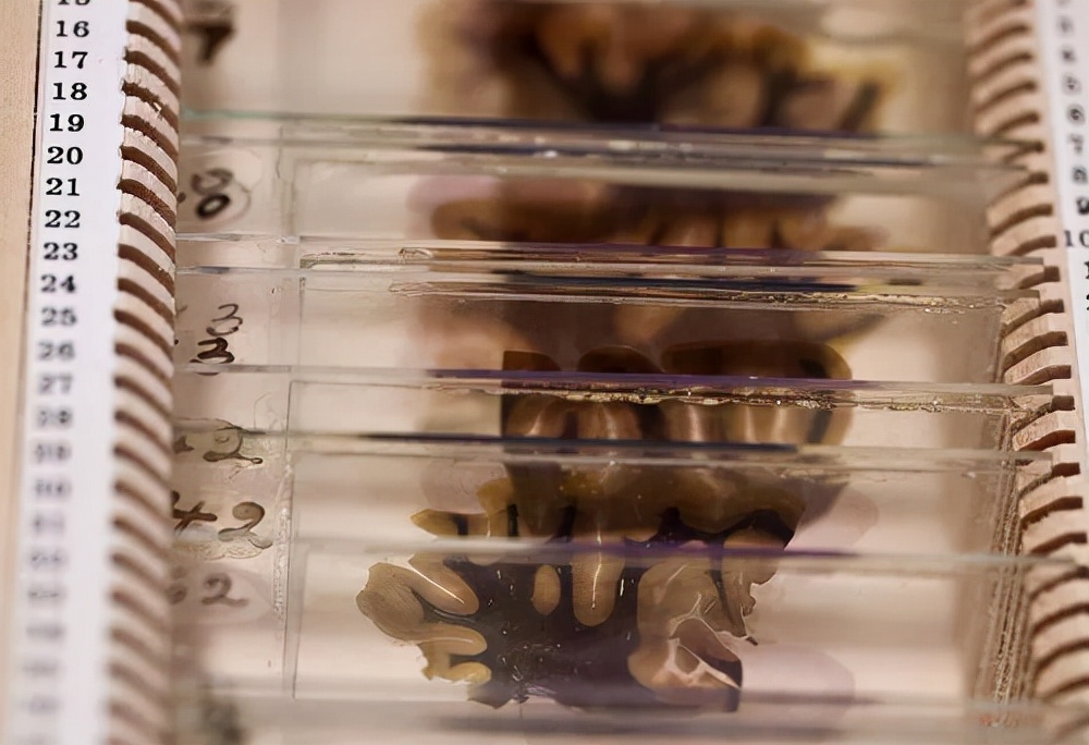 爱因斯坦的大脑在哪个博物馆,爱因斯坦的大脑为科学奉献一生