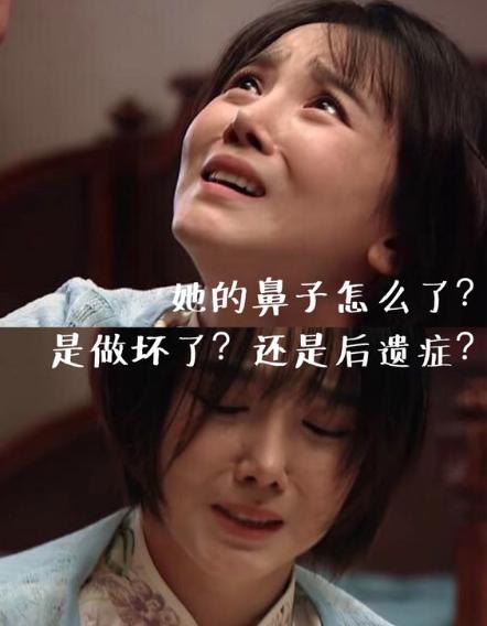 整容后的女明星老了,整容严重变性的女明星