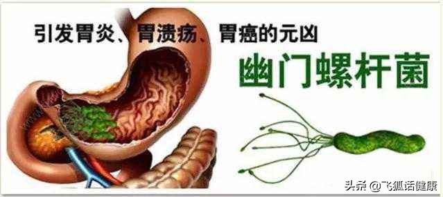 幽门螺杆菌hp参数,幽门螺杆菌hp阳性怎么治疗