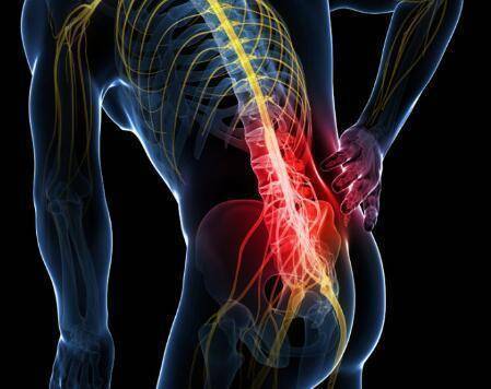 腰部突然疼痛是否有其它病变,腰部突然疼会是得了癌症吗