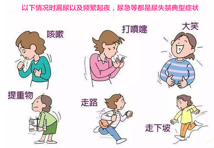 一笑就漏尿怎么治疗,孩子一笑就漏尿怎么办