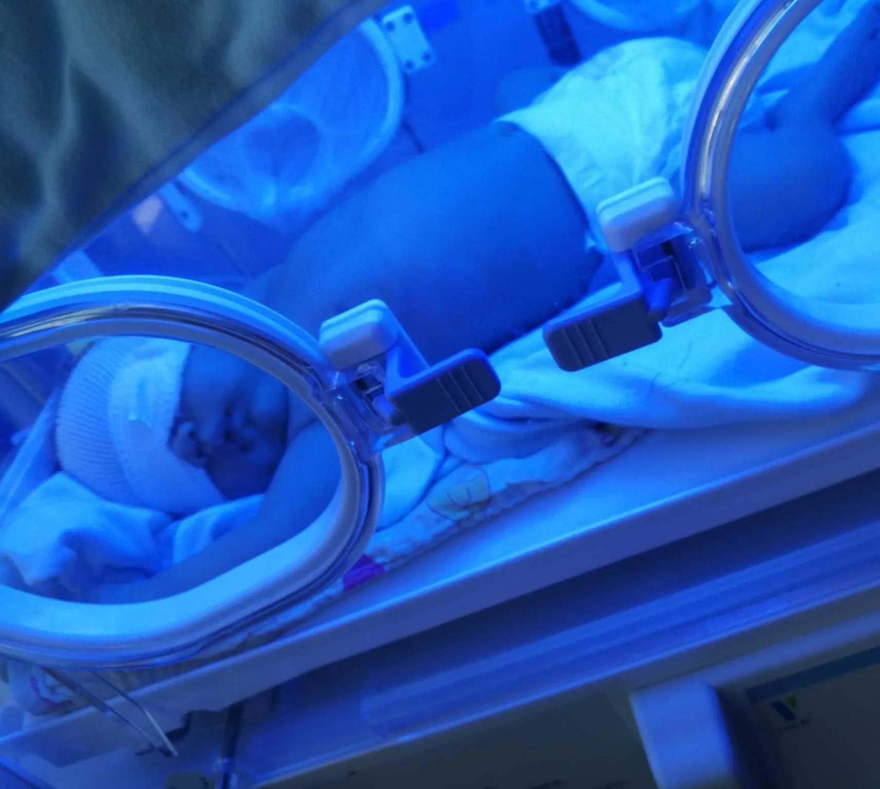 宝宝照蓝光退了皮肤就不黄了吗,宝宝照蓝光能吃退黄药吗