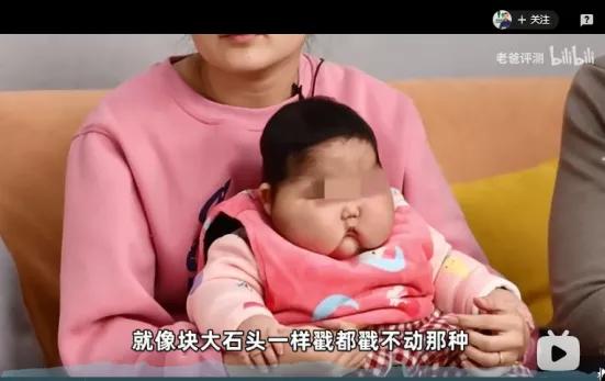 宝宝霜对婴儿湿疹有作用吗,宝宝湿疹可以用婴儿霜