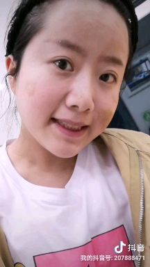 陈金西细胞种植术真实案例,陈金西细胞再生技术疤痕修复