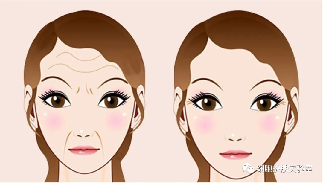 修复眉间纹最好的方法,额头皱纹眉间纹