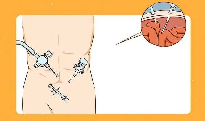 过敏宝宝吃营养包有危害吗,过敏宝宝营养包有必要吃吗