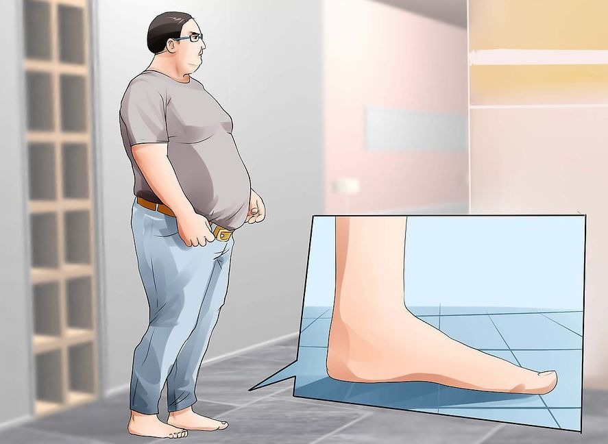 穿软底鞋会足弓塌陷吗,单侧足弓塌陷锻炼方法