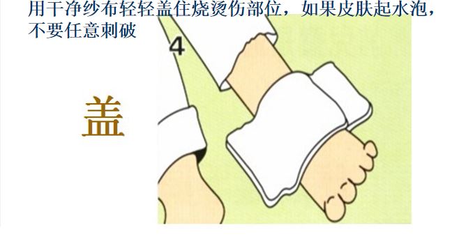 孩子烫伤记住5个字,牢记五字口诀轻松处理宝宝烫伤