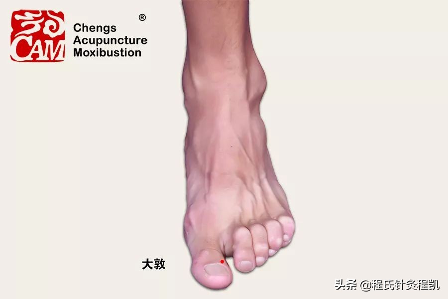 中医证型：脾胃湿热是怎么回事，该如何调理？