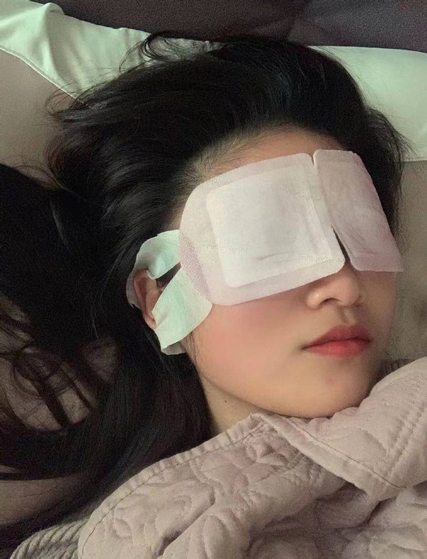 眼部细纹最好的护理,眼周细纹干纹鱼尾纹护理