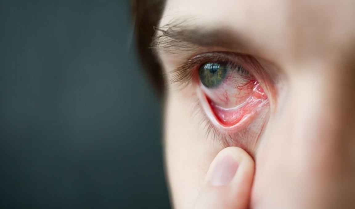 肝豆状核变性杂合突变,肝豆状核变性谷丙转氨酶会高吗